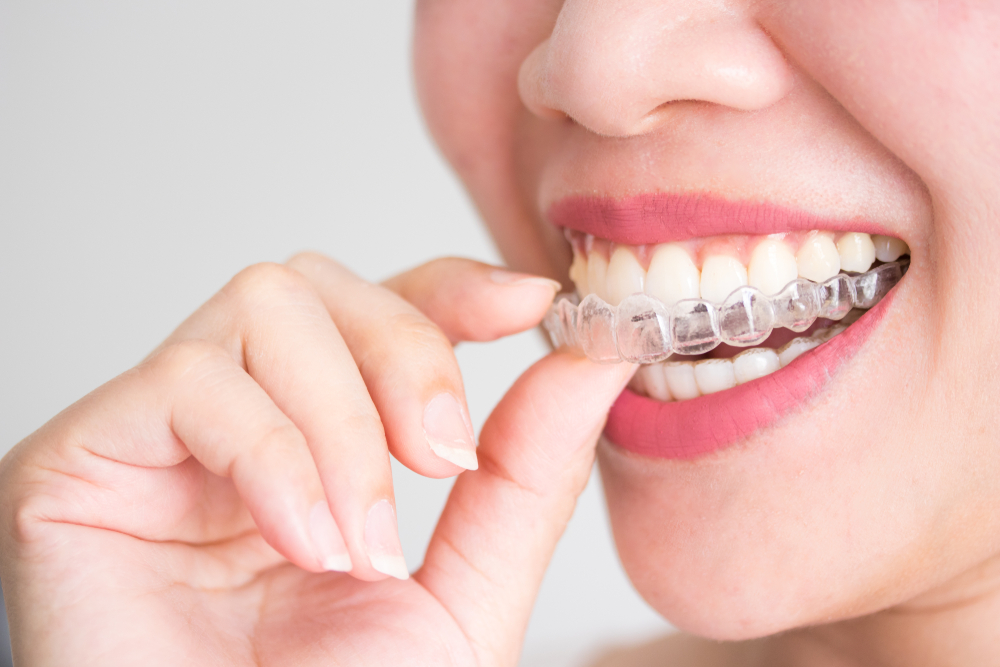 A,Smiling,Woman,Holding,Invisalign,Or,Invisible,Braces,,Orthodontic,Equipment