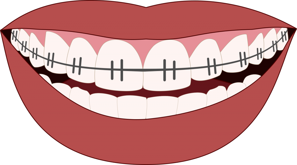 straight-teeth