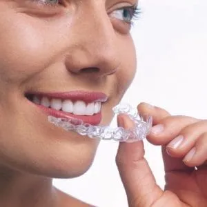 invisalign image