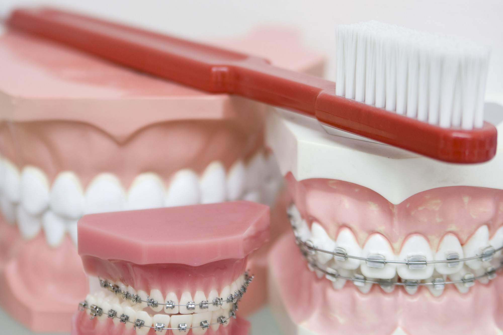 Zähne und Zahnbürste